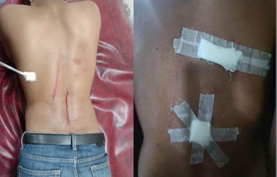ছিনতাইকারীর ছুরিকাঘাতে রাবি শিক্ষার্থী আহত