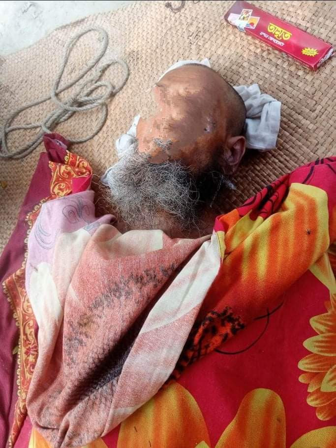 রাঙ্গাবালী‌তে বৃদ্ধার আত্মহত্যা,  লাশ উদ্ধার