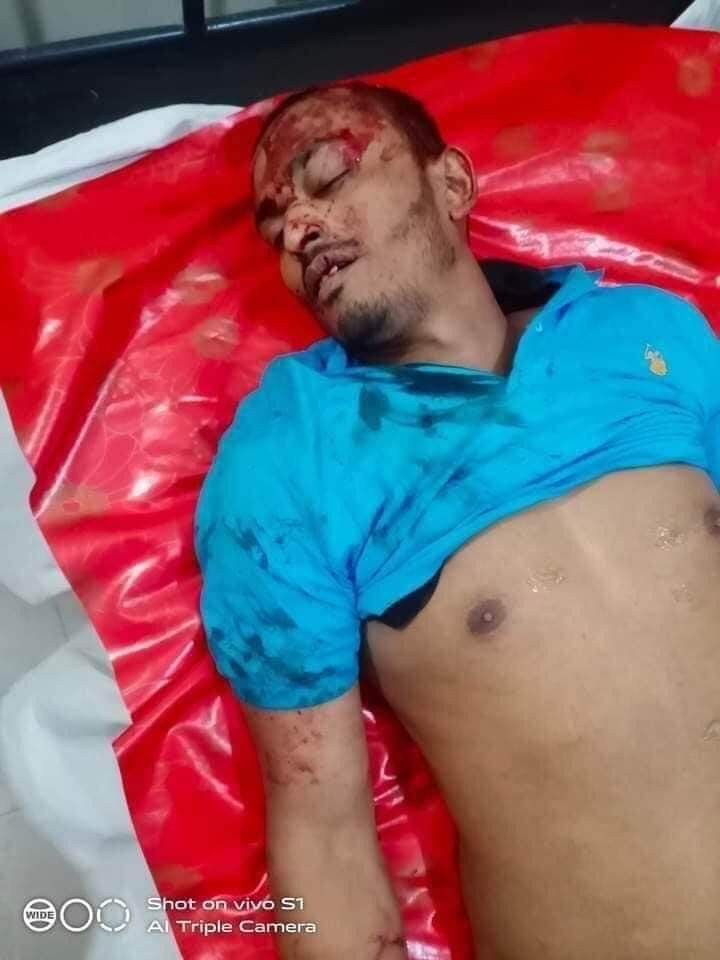 লক্ষ্মীপুরে যুবলীগ ও ছাত্রলীগ গুলি করে হত্যা প্রতিবাদে লক্ষ্মীপুরে বিক্ষোভ